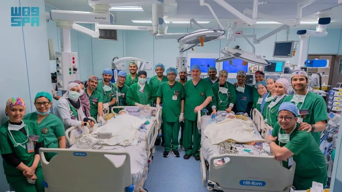السعودية: نجاح فصل التوأم الملتصق الفلبيني بعد عملية جراحية معقدة